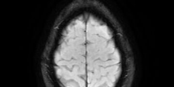 Which Brain Region Regulates Hunger And Thirst?