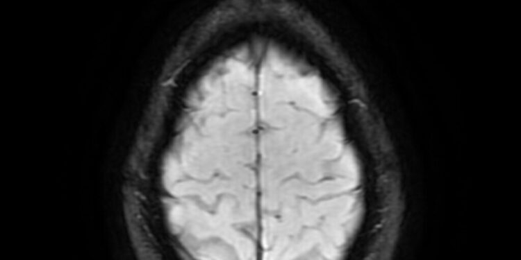 Which Brain Region Regulates Hunger And Thirst?