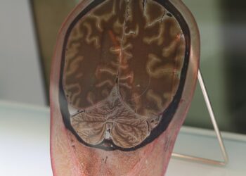 What Percentage Of The Human Brain Is Water?