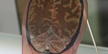 What Percentage Of The Human Brain Is Water?