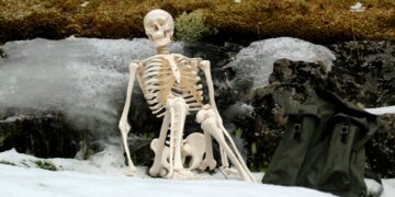 How Many Bones Are In The Adult Human Body?