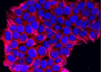 Which Condition Occurs When The Immune System Attacks The Myelin Sheath Of Nerve Cells?