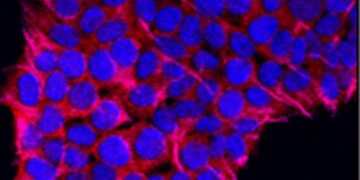 Which Condition Occurs When The Immune System Attacks The Myelin Sheath Of Nerve Cells?