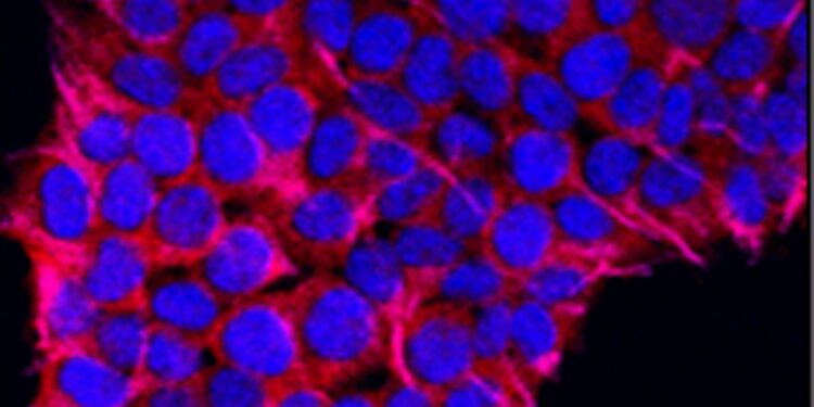 Which Condition Occurs When The Immune System Attacks The Myelin Sheath Of Nerve Cells?