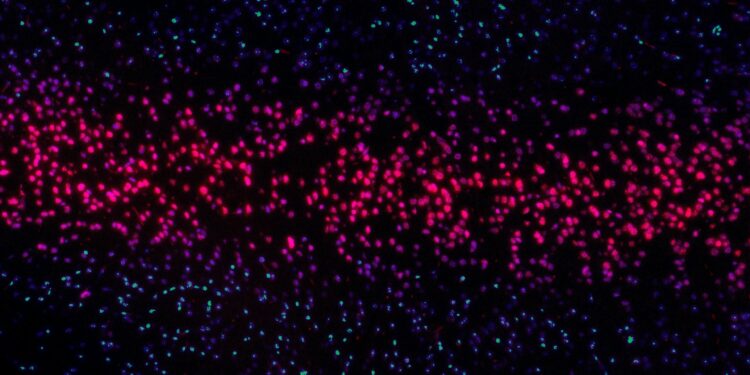 Which Lifestyle Factor Is Linked To Telomere Shortening?