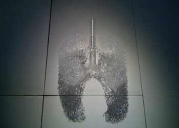 What Is The Primary Purpose Of Surfactant In The Lungs?