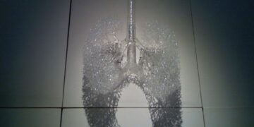 What Is The Primary Purpose Of Surfactant In The Lungs?