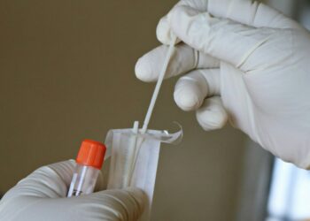 Cheek Swab Test Claims To Predict Lifespan