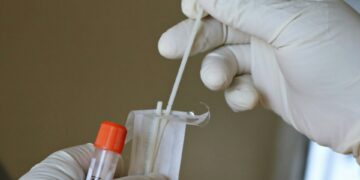 Cheek Swab Test Claims To Predict Lifespan