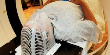 Which Disorder Involves Abnormal Brain Electrical Activity And Recurrent Seizures?