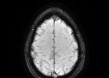 What Does The Pineal Gland Do?