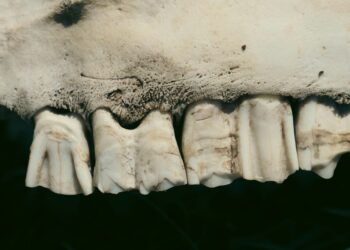 Popular Thyroid Medication May Harm Bone Strength