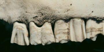 Popular Thyroid Medication May Harm Bone Strength