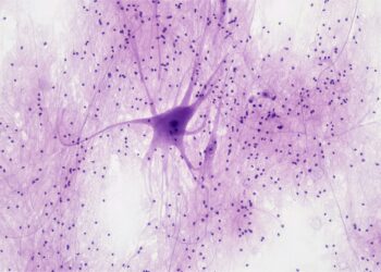 Neurological Disease Treatment Shows Incredible Potential