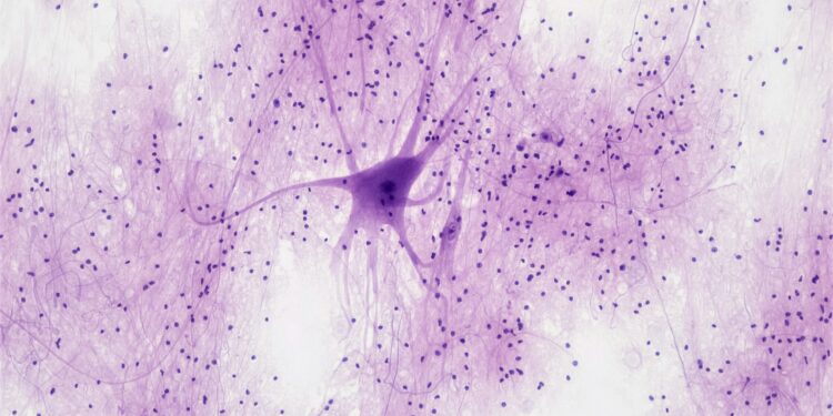 Neurological Disease Treatment Shows Incredible Potential