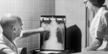 Woman Receives Groundbreaking Robotic Transplant