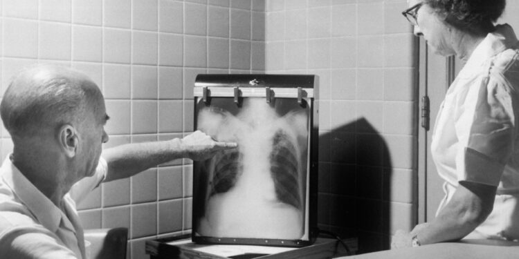 Woman Receives Groundbreaking Robotic Transplant