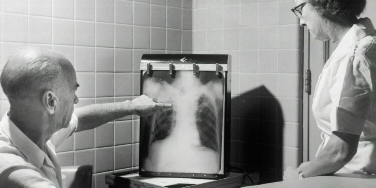 Deadliest Infectious Disease Makes Comeback