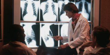 Expert Breaks Down Critical Heart Warning Signs