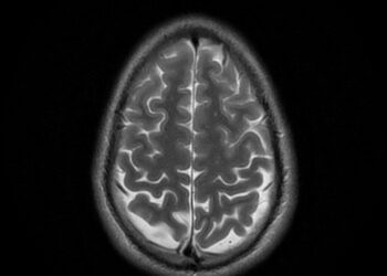 Which Part Of The Brain Forms Memories?