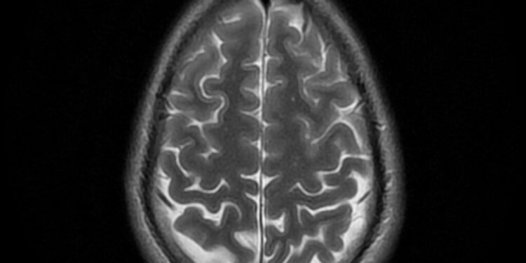 Which Part Of The Brain Forms Memories?