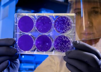 Which Of The Following Is A Type Of “Good” Bacteria That Supports Gut Health?