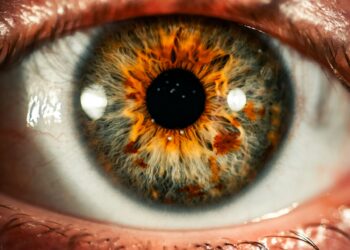 What Is The Term For Unequal Pupil Size?