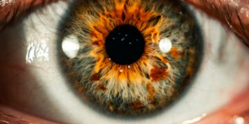 What Is The Term For Unequal Pupil Size?