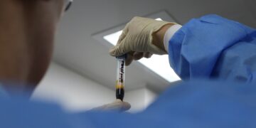 What Is The Normal pH Range Of Human Blood?