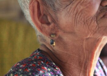 What Is The Term For The Sensation Of Spinning Due To Inner Ear Issues?