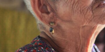 What Is The Term For The Sensation Of Spinning Due To Inner Ear Issues?