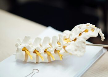 What Condition Causes Abnormal Spine Curvature?