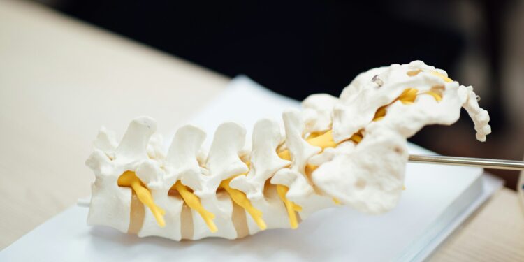 What Condition Causes Abnormal Spine Curvature?