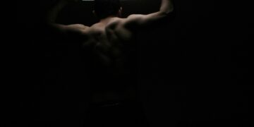 What Is The Condition Causing Excessive Upper Back Curvature?