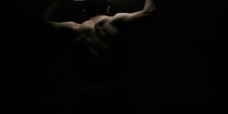 What Is The Condition Causing Excessive Upper Back Curvature?