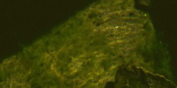 New Superfood Set To Supercharge The Brain