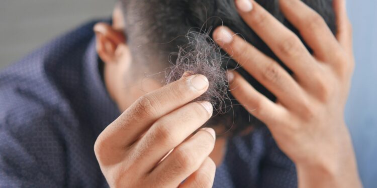 What Condition Causes The Immune System To Attack Hair Follicles?
