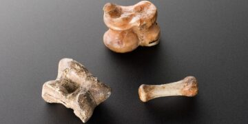 What Is The Name Of The Disorder Known As “Brittle Bone Disease”?