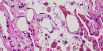 What Is The Term For Fat That Regulates Temperature And Burns Calories?