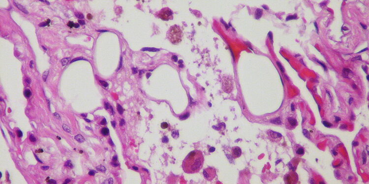 What Is The Term For Fat That Regulates Temperature And Burns Calories?