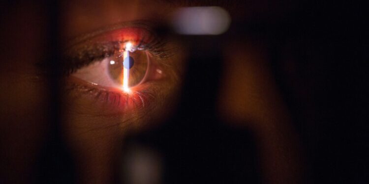 Stem Cell Therapy Heals Irreversible Cornea Damage