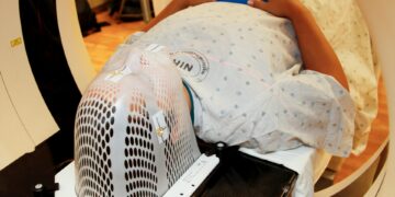 Powerful MRI Technology Transforms Epilepsy Surgery Outcomes