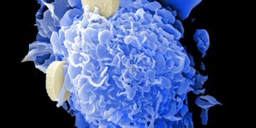 What Is The Term For Liver Inflammation Caused By Viruses, Alcohol, Or Toxins?