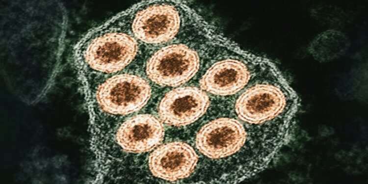 Rabies Claims Life Of Organ Transplant Patient