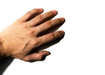 What Is The Medical Term For Blood Clots In Deep Veins?