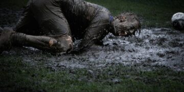 What Condition Causes Temporary Loss Of Motor Function On One Side Of The Body?