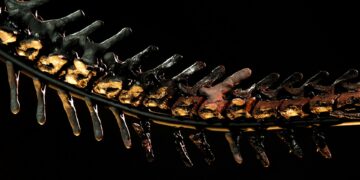 What’s The Term For The Natural Process Of Losing Bone Density With Age?