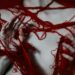 New Threat Linked To Artery Blockage