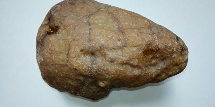 Blood Test Uncovers Fatty Liver Disease Before Symptoms Appear