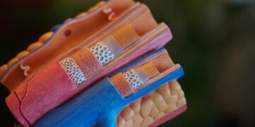 What Condition Narrows Arteries, Reducing Blood Flow To Limbs?